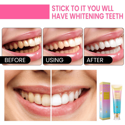 Pâte dentifrice blanchissante | BodyAccel™