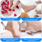 Outil de Pédicure Professionnel BoutyP™ | Élimine Callosités et Peaux Mortes