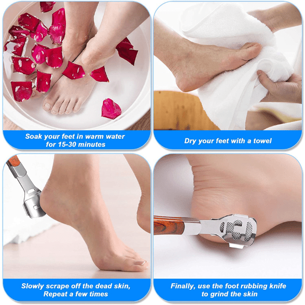 Outil de Pédicure Professionnel BoutyP™ | Élimine Callosités et Peaux Mortes