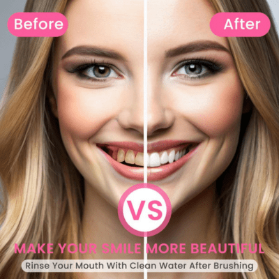 Pâte dentifrice blanchissante  | BodyAccel™